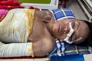 Báo SGGP trao 30 triệu đồng cho người đàn ông bị bỏng nặng