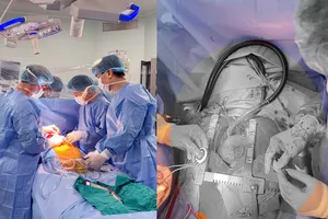 Ca cấy ghép thiết bị hỗ trợ tim CorHeart 6 đầu tiên tại Việt Nam