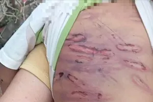 Liên tiếp các vụ bạo hành trẻ em: Đề nghị xử nghiêm việc che giấu, không tố giác 