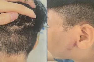 Triệu tập người cha nghi đánh con ruột nhập viện