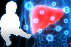 多國出現不明原因兒童急性肝炎