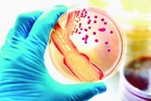 猴痘病患者的血液感染病毒致死亡危機。