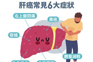 肝癌前兆必知6大症狀