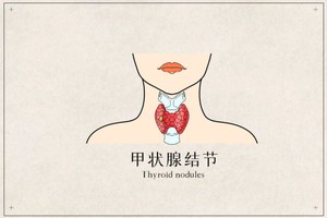 甲狀腺疾病具體分為哪些種類？