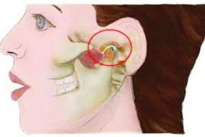 打哈欠、吃东西，嘴巴合不上或得了这种病