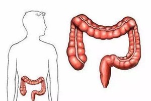 肛肠病常见症状表现