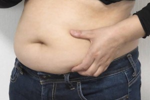 全球超10亿人患肥胖症