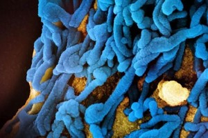 卢旺达马尔堡病毒病疫情得到控制