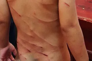 Cha dượng ở Phú Quốc đánh dã man bé trai 3 tuổi  