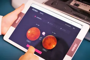 Sử dụng AI để phân tích những hình ảnh chụp võng mạc ở mặt sau của mỗi nhãn cầu