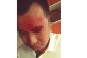 Ông Thiện bị nhóm người lạ đánh trọng thương tại  trụ sở Công ty cổ phần Đầu tư Thương mại và Dịch vụ Việt Úc 