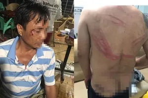 Truy xét nhóm côn đồ vào nhà dân tấn công khiến nhiều người bị thương