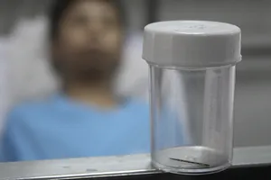 Phẫu thuật lấy kim khâu rỉ sét nằm trong tim trái bé 13 tuổi