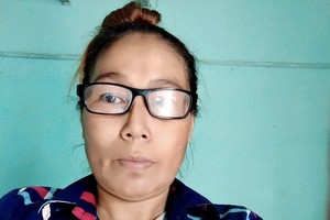 中年妇女患晚期肾衰竭难撑长期医疗费