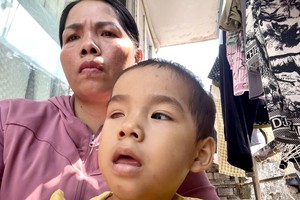 何氏娇兄和患眼疾女儿郑柯儿。