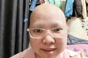 在医治癌症中的何美美。