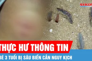Thực hư thông tin bé 3 tuổi bị sâu biển cắn nguy kịch