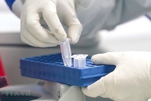 Japan helps HCMC Pasteur Institute respond to COVID-19