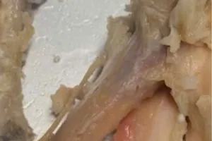 Bữa ăn bán trú với món thịt gà còn dính máu được phụ huynh phản ánh trong đơn gửi cơ quan chức năng