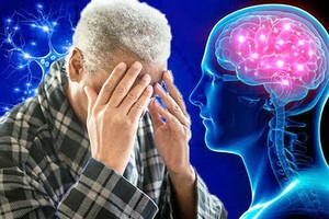 老年痴呆症状加重不仅影响自己的生活，还给儿女造成巨大的负担。