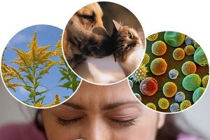 定期清洁家居环境有助减轻过敏症状。