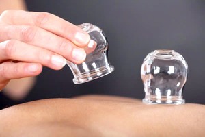 拔火罐不是人人都适合。