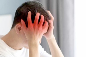 年轻人脑中风的发生率正在上升。