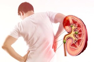 肾衰竭有年轻化趋势。