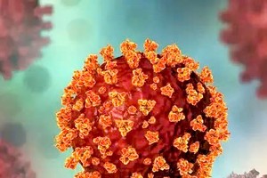 新变异株NB.1.8.1与先前的新冠肺炎变异株相比有一些不同的症状。