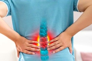 腰痛原因除了腰椎问题，还可能与其他系统疾病有关。