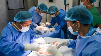 Một ca ghép thận tại Bệnh viện Nhân dân 115