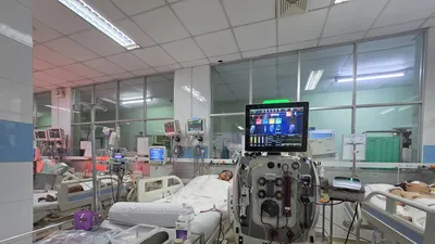 Một ca sốt xuất huyết nặng, nguy kịch điều trị tại Bệnh viện Bệnh Nhiệt đới (TPHCM) Ảnh: THÀNH AN