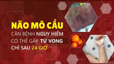 TPHCM: Ghi nhận ca bệnh do não mô cầu tại xã Thường Tân