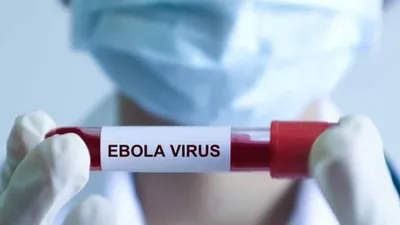 Hơn 80 ca tử vong nghi do nhiễm virus Ebola ở Congo, Bộ Y tế ra thông báo khẩn 