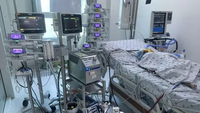 Tác nhân phổ biến nhất gây viêm màng não vi khuẩn ở trẻ nhỏ