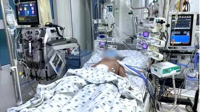 Liên tiếp cứu sống trẻ bị suy tạng do sốc sốt xuất huyết nặng