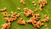 Bacterium Staphylococcus causes 42 percent of food poisoning | Health ...