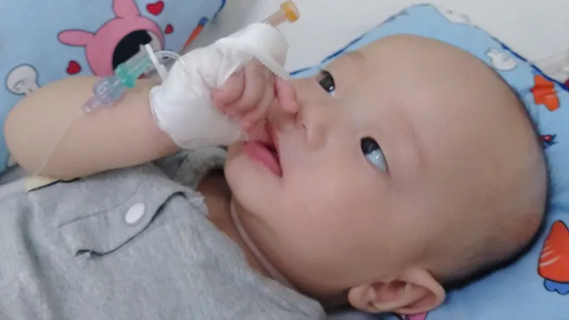 Bé trai 6 tháng tuổi bị viêm tủy cột sống, nguy cơ bại liệt