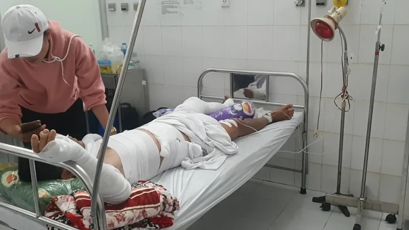  Nổ ghe lưới ghẹ ở Cà Mau, 3 người bị bỏng nặng