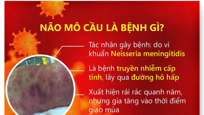Cà Mau: Kết thúc ổ dịch bệnh não mô cầu liên quan đến 1 ca tử vong