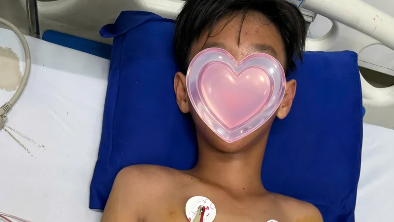 Cà Mau: Cứu sống bé trai đi rừng bị ong vò vẽ đốt hơn 50 vết 
