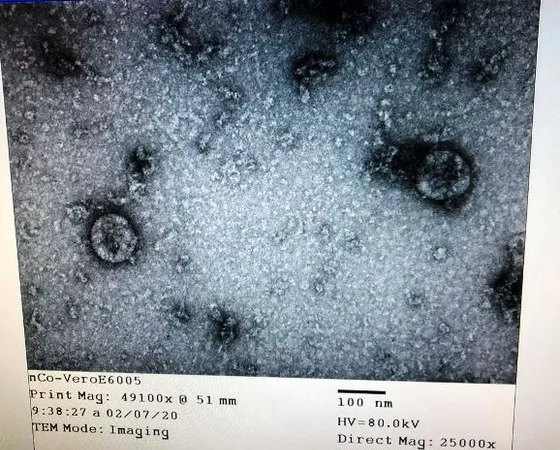 Hình ảnh virus Corona được phân lập, nuôi cấy thành công tại Viện Vệ sinh dịch tế Trung ương