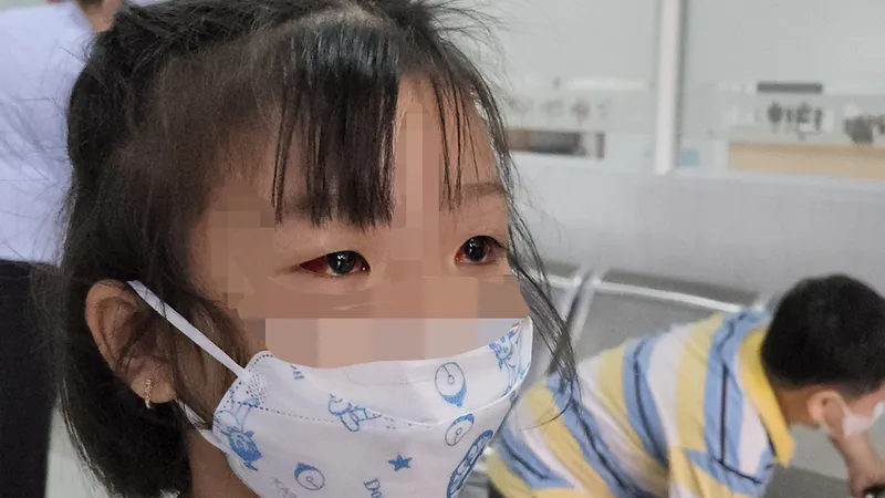 Không tự ý sử dụng các thuốc nhỏ mắt có chứa corticoid, kháng sinh 