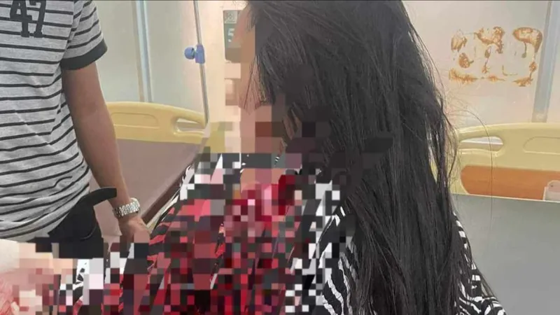 Vụ người phụ nữ 2 lần bị truy sát: Bắt được nghi phạm 
