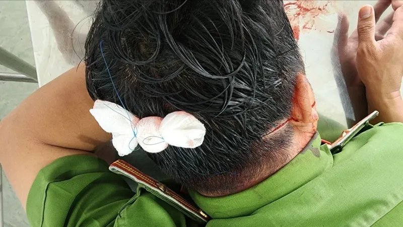 Tạm giữ đối tượng ném đá hàng loạt ô tô, chém cán bộ công an nhập viện