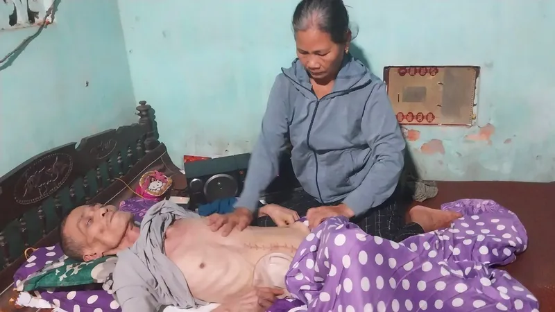 Gia cảnh bi đát vì chồng mù mắt, ung thư di căn