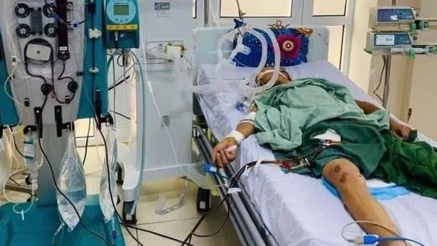 Nguy kịch sau 5 giờ mổ heo chết 