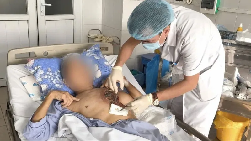 Bệnh nhân T. được bác sĩ chăm sóc sau ca phẫu thuật