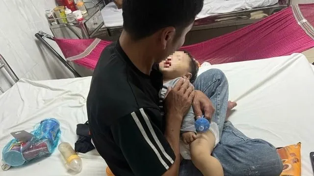 Vụ bé 9 tháng tuổi bị bầm má: Xử phạt điểm trông giữ trẻ “chui”