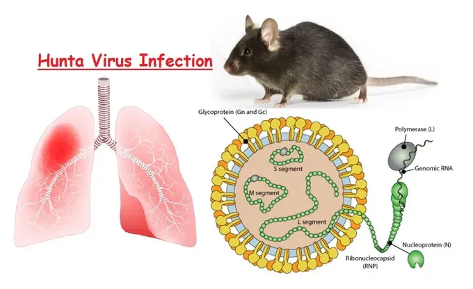 Health watchdog issues alert after Hanta virus cluster found on cruise ship
